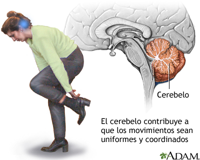 Cerebelo: Funciones, Anatomía y Enfermedades Clave 2 cerebelo funciones anatomia y enfermedades clave 1