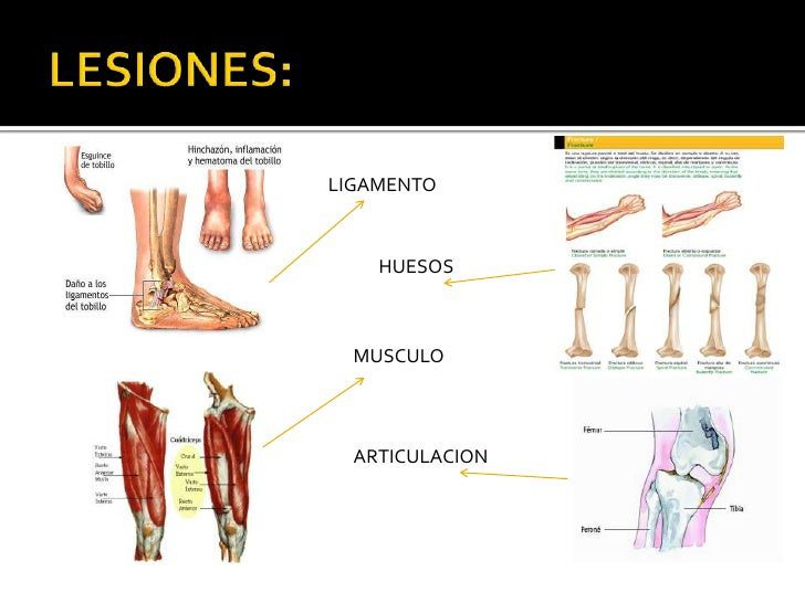 cuidados fundamentales para el aparato locomotor guia completa