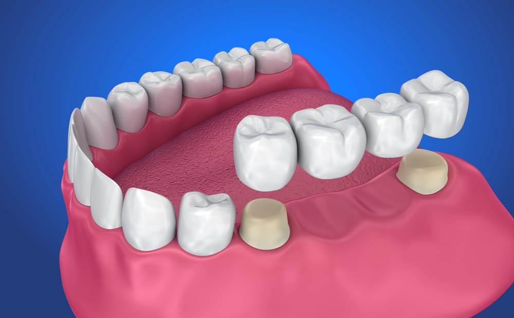 Qué son los dientes: definición y concepto explicados 2 que son los dientes definicion y concepto explicados 1
